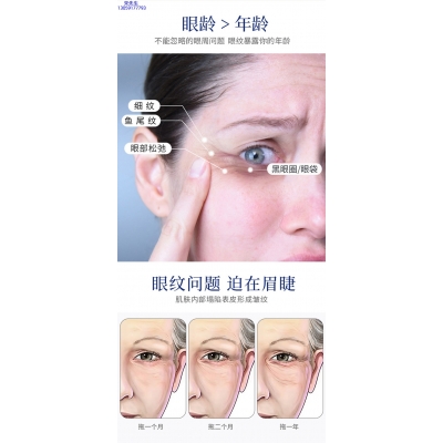伊犁哈萨克自治州_美容院玻尿酸微针眼贴